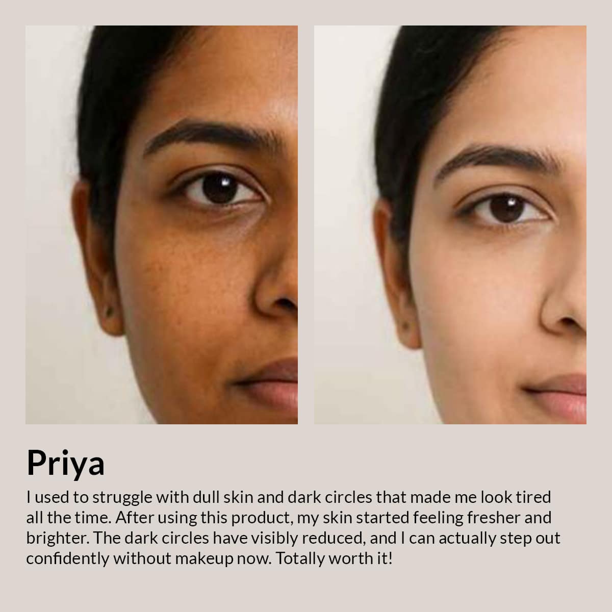 Camel Milk Skin Brightening Night Cream with Niacinamide &amp; Vitamin C -2.6%