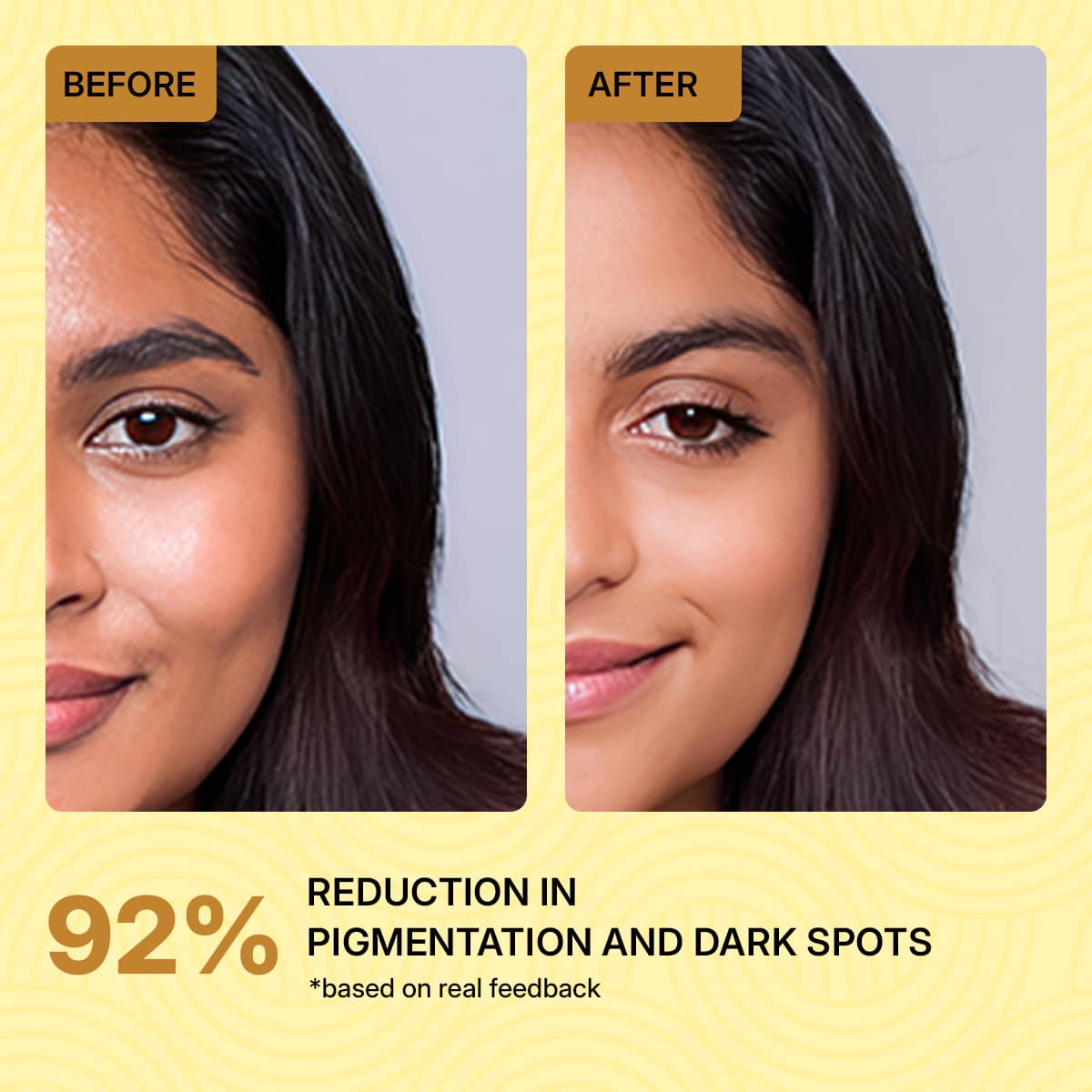 Camel Milk Skin Brightening Serum with Vitamin C + Alpha Arbutin 1.5%